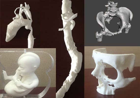 High standard 3D printing for medical, industrial and artistic modeling and fast prototyping.